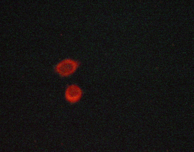 NFKBIA / IKB Alpha / IKBA Antibody - Staining LOVO cells by IF/ICC. The samples were fixed with PFA and permeabilized in 0.1% saponin prior to blocking in 10% serum for 45 min at 37°C. The primary antibody was diluted 1/400 and incubated with the sample for 1 hour at 37°C. A Alexa Fluor® 594 conjugated goat polyclonal to rabbit IgG (H+L), diluted 1/600 was used as secondary antibody.
