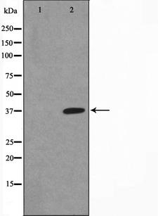 NFKBIA / IKB Alpha / IKBA Antibody - Western blot analysis of IkappaB-alpha phosphorylation expression in COS7 whole cells lysates. The lane on the left is treated with the antigen-specific peptide.
