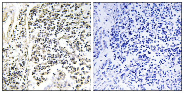NFKBIA / IKB Alpha / IKBA Antibody - Immunohistochemistry analysis of paraffin-embedded human lymph node, using IkappaB-alpha (Phospho-Tyr305) Antibody. The picture on the right is blocked with the phospho peptide.
