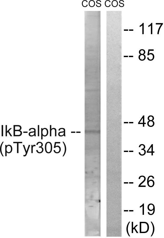 NFKBIA / IKB Alpha / IKBA Antibody - Western blot analysis of lysates from COS7 cells treated with nocodazole 1ug/ml 16h, using IkappaB-alpha (Phospho-Tyr305) Antibody. The lane on the right is blocked with the phospho peptide.