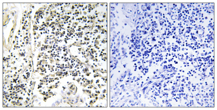 NFKBIA / IKB Alpha / IKBA Antibody - Immunohistochemistry of paraffin-embedded human lymph node tissue using I kappa B- alpha (Phospho-Tyr305) antibody.