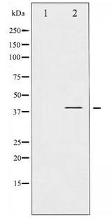 NFKBIA / IKB Alpha / IKBA Antibody - Western blot of I kappaB- alpha phosphorylation expression in nocodazole treated COS7 whole cell lysates,The lane on the left is treated with the antigen-specific peptide.