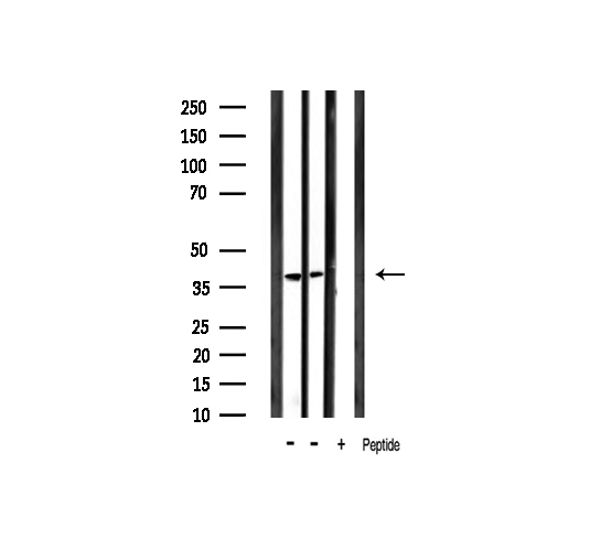 NFKBIA / IKB Alpha / IKBA Antibody - Western blot analysis of IkappaB-alpha phosphorylation expression in mouse muscle and mouse brain lysates. The lane on the right is treated with the antigen-specific peptide.