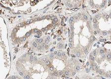 NFKBIA / IKB Alpha / IKBA Antibody - 1:100 staining human kidney tissue by IHC-P. The tissue was formaldehyde fixed and a heat mediated antigen retrieval step in citrate buffer was performed. The tissue was then blocked and incubated with the antibody for 1.5 hours at 22°C. An HRP conjugated goat anti-rabbit antibody was used as the secondary.