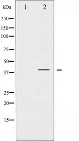 NFKBIA / IKB Alpha / IKBA Antibody - Western blot analysis of IkappaB-alpha phosphorylation expression in nocodazole treated COS7 whole cells lysates. The lane on the left is treated with the antigen-specific peptide.