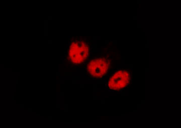 NFKBIA / IKB Alpha / IKBA Antibody - Staining MCF-7 cells by IF/ICC. The samples were fixed with PFA and permeabilized in 0.1% Triton X-100, then blocked in 10% serum for 45 min at 25°C. The primary antibody was diluted at 1:200 and incubated with the sample for 1 hour at 37°C. An Alexa Fluor 594 conjugated goat anti-rabbit IgG (H+L) Ab, diluted at 1/600, was used as the secondary antibody.
