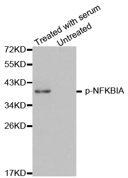 NFKBIA / IKB Alpha / IKBA Antibody - Western blot analysis of extracts of HeLa cellss.