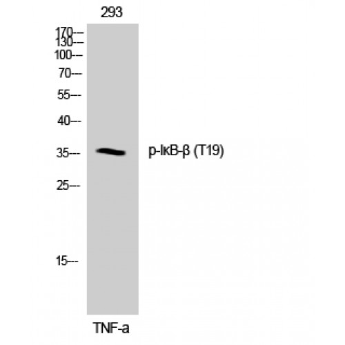 NFKBIB / IKB Beta / IKBB Antibody - Western blot of Phospho-IkappaB-beta (T19) antibody