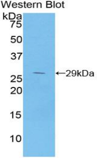 NFKBIB / IKB Beta / IKBB Antibody - Western blot of recombinant NFKBIB / IKB Beta / IKBB.  This image was taken for the unconjugated form of this product. Other forms have not been tested.
