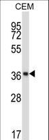 NFKBIB / IKB Beta / IKBB Antibody - NFKBIB Antibody western blot of CEM cell line lysates (35 ug/lane). The NFKBIB antibody detected the NFKBIB protein (arrow).
