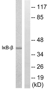 NFKBIB / IKB Beta / IKBB Antibody - Western blot analysis of lysates from NIH/3T3 cells, treated with TNF 20ng/ml 30', using IkappaB-beta Antibody. The lane on the right is blocked with the synthesized peptide.