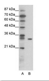 NFKBIB / IKB Beta / IKBB Antibody - A: Marker, B: Jurkat Cell Lysate.  This image was taken for the unconjugated form of this product. Other forms have not been tested.