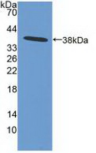 NFKBIB / IKB Beta / IKBB Antibody - Western Blot; Sample: Recombinant IkBb, Human.