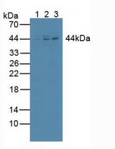 NFKBIB / IKB Beta / IKBB Antibody - Western Blot; Sample: Lane1: Human Lung Tissue; Lane2: Human Hela Cells; Lane3: Human Jurkat Cells.