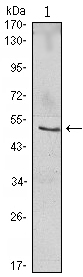NFKBIB / IKB Beta / IKBB Antibody - Western blot using NFKBIB mouse monoclonal antibody against Jurkat (1) cell lysate.