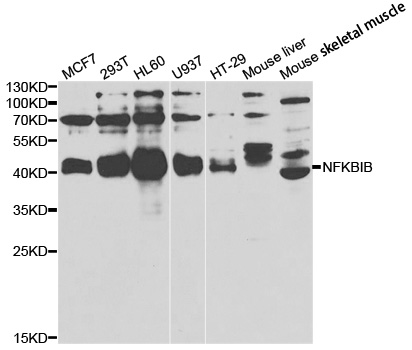 NFKBIB / IKB Beta / IKBB Antibody - Western blot analysis of extracts of various cell lines.