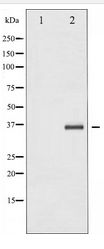 NFKBIB / IKB Beta / IKBB Antibody - Western blot of IkappaB-beta expression in TNF treated NIH-3T3 whole cell lysates,The lane on the left is treated with the antigen-specific peptide.