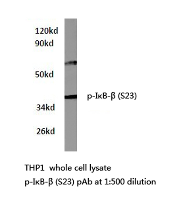 NFKBIB / IKB Beta / IKBB Antibody - Western blot of p-IB- (pSer23) pAb in extracts from THP1 cells.