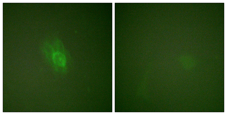 NFKBIB / IKB Beta / IKBB Antibody - Immunofluorescence analysis of HeLa cells treated with TNF-a 20nM 15', using IkappaB-beta (Phospho-Ser23) Antibody. The picture on the right is blocked with the phospho peptide.