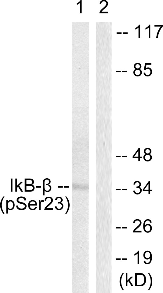 NFKBIB / IKB Beta / IKBB Antibody - Western blot analysis of lysates from HeLa cells treated with TNF-a 20ng/ml 5', using IkappaB-beta (Phospho-Ser23) Antibody. The lane on the right is blocked with the phospho peptide.