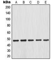 NFKBIB / IKB Beta / IKBB Antibody - Western blot analysis of IKK beta (pS23) expression in HEK293T LPS-treated (A); SP2/0 LPS-treated (B); PC12 LPS-treated (C); HT29 (D); NIH3T3 TNFa-treated (E) whole cell lysates.
