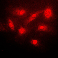 NFKBIB / IKB Beta / IKBB Antibody - Immunofluorescent analysis of IKK beta (pS23) staining in PC12 cells. Formalin-fixed cells were permeabilized with 0.1% Triton X-100 in TBS for 5-10 minutes and blocked with 3% BSA-PBS for 30 minutes at room temperature. Cells were probed with the primary antibody in 3% BSA-PBS and incubated overnight at 4 C in a humidified chamber. Cells were washed with PBST and incubated with a DyLight 594-conjugated secondary antibody (red) in PBS at room temperature in the dark. DAPI was used to stain the cell nuclei (blue).