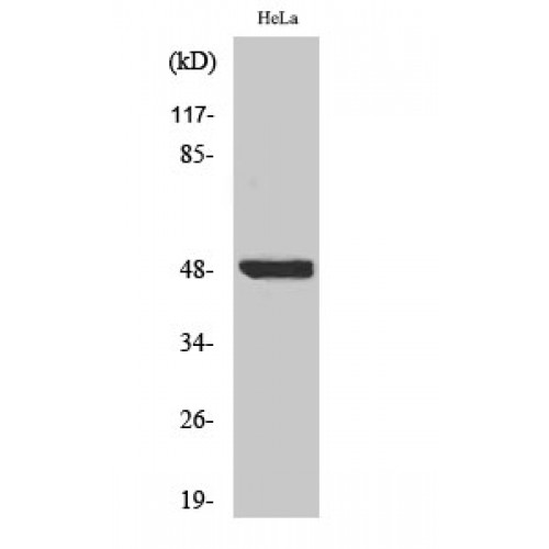 NFKBIB / IKB Beta / IKBB Antibody - Western blot of Phospho-IkappaB-beta (pSer23) antibody