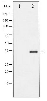 NFKBIB / IKB Beta / IKBB Antibody - Western blot of I kappaB- beta phosphorylation expression in TNF-a treated HeLa whole cell lysates,The lane on the left is treated with the antigen-specific peptide.