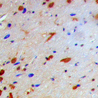 NFKBIB / IKB Beta / IKBB Antibody - Immunohistochemical analysis of IKK beta (pT19) staining in human brain formalin fixed paraffin embedded tissue section. The section was pre-treated using heat mediated antigen retrieval with sodium citrate buffer (pH 6.0). The section was then incubated with the antibody at room temperature and detected using an HRP conjugated compact polymer system. DAB was used as the chromogen. The section was then counterstained with hematoxylin and mounted with DPX.