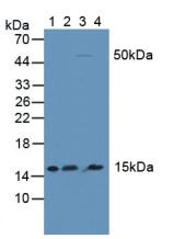 NFKBID / IkappaBNS Antibody - Western Blot; Sample: Lane1: Human Serum; Lane2: Human Liver Tissue; Lane3: Mouse Kidney Tissue; Lane4: Human Lung Tissue.