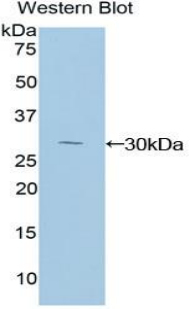 NFKBID / IkappaBNS Antibody - Western blot of recombinant NFKBID / IkappaBNS.  This image was taken for the unconjugated form of this product. Other forms have not been tested.