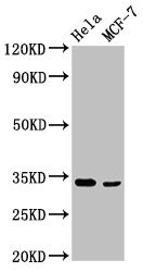 NFKBID / IkappaBNS Antibody - Western Blot Positive WB detected in: Hela whole cell lysate, MCF-7 whole cell lysate All lanes: NFKBID antibody at 3.4µg/ml Secondary Goat polyclonal to rabbit IgG at 1/50000 dilution Predicted band size: 34, 51, 16 kDa Observed band size: 34 kDa