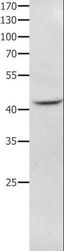 NFKBID / IkappaBNS Antibody - Western blot analysis of RAW264.7 cell, using NFKBID Polyclonal Antibody at dilution of 1:650.