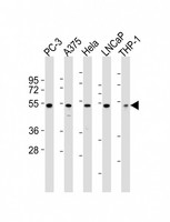 NFKBIE / IKB Epsilon Antibody - All lanes : Anti-NFKBIE Antibody at 1:2000 dilution Lane 1: PC-3 whole cell lysates Lane 2: A375 whole cell lysates Lane 3: HeLa whole cell lysates Lane 4: LNCaP whole cell lysates Lane 5: THP-1 whole cell lysates Lysates/proteins at 20 ug per lane. Secondary Goat Anti-Rabbit IgG, (H+L), Peroxidase conjugated at 1/10000 dilution Predicted band size : 53 kDa Blocking/Dilution buffer: 5% NFDM/TBST.
