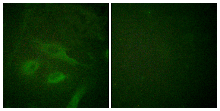 NFKBIE / IKB Epsilon Antibody - Immunofluorescence analysis of HeLa cells, using IkappaB-epsilon Antibody. The picture on the right is blocked with the synthesized peptide.