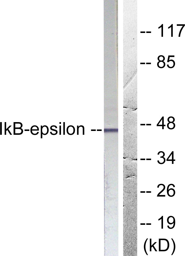 NFKBIE / IKB Epsilon Antibody - Western blot analysis of lysates from HeLa cells, treated with TNF-a 20ng/ml 5', using IkappaB-epsilon Antibody. The lane on the right is blocked with the synthesized peptide.