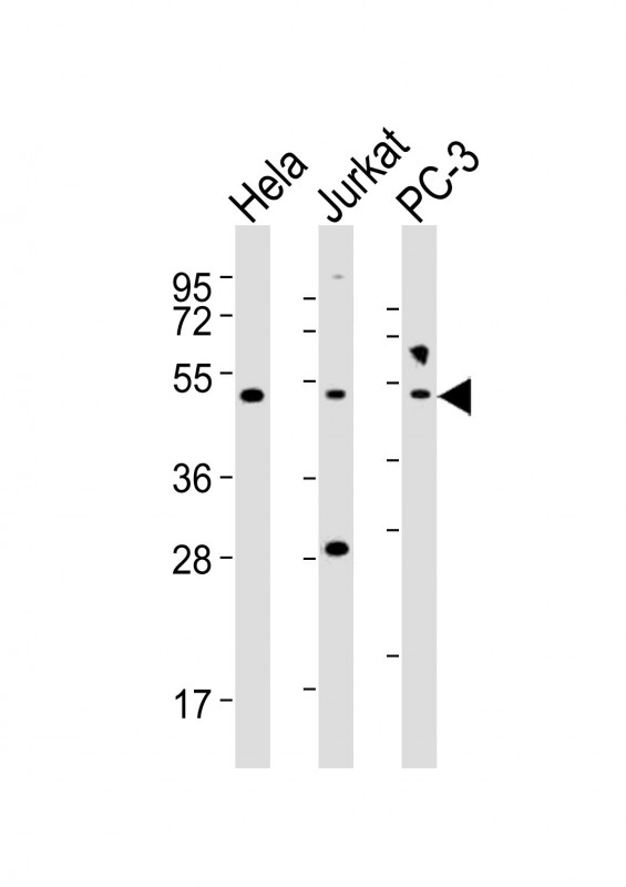 NFKBIE / IKB Epsilon Antibody - All lanes : Anti-NFKBIE Antibody at 1:2000 dilution Lane 1: HeLa whole cell lysates Lane 2: Jurkat whole cell lysates Lane 3: PC-3 whole cell lysates Lysates/proteins at 20 ug per lane. Secondary Goat Anti-Rabbit IgG, (H+L), Peroxidase conjugated at 1/10000 dilution Predicted band size : 53 kDa Blocking/Dilution buffer: 5% NFDM/TBST.