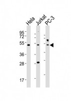 NFKBIE / IKB Epsilon Antibody - All lanes : Anti-NFKBIE Antibody at 1:2000 dilution Lane 1: HeLa whole cell lysates Lane 2: Jurkat whole cell lysates Lane 3: PC-3 whole cell lysates Lysates/proteins at 20 ug per lane. Secondary Goat Anti-Rabbit IgG, (H+L), Peroxidase conjugated at 1/10000 dilution Predicted band size : 53 kDa Blocking/Dilution buffer: 5% NFDM/TBST.
