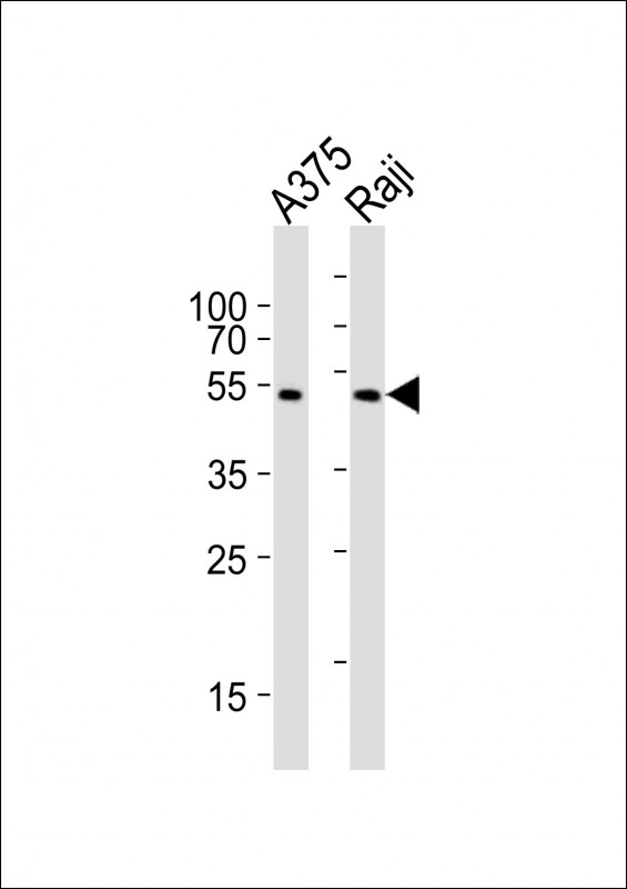 NFKBIE / IKB Epsilon Antibody - All lanes : Anti-NFKBIE Antibody at 1:1000 dilution Lane 1: A375 whole cell lysates Lane 2: Raji whole cell lysates Lysates/proteins at 20 ug per lane. Secondary Goat Anti-Rabbit IgG, (H+L), Peroxidase conjugated at 1/10000 dilution Predicted band size : 53 kDa Blocking/Dilution buffer: 5% NFDM/TBST.