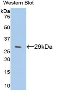 NFKBIE / IKB Epsilon Antibody - Western blot of recombinant NFKBIE / IKB Epsilon.  This image was taken for the unconjugated form of this product. Other forms have not been tested.