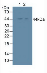 NFKBIE / IKB Epsilon Antibody - Western Blot; Sample: Lane1: Human Hela Cells; Lane2: Human A375 Cells.