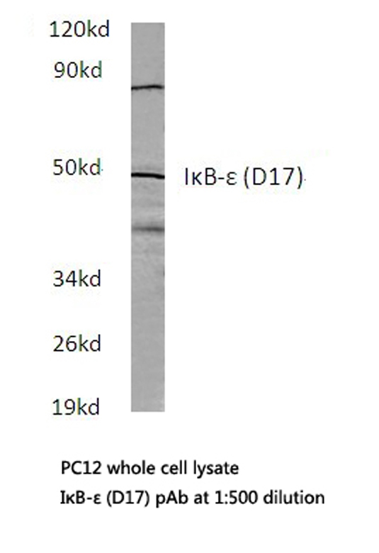 NFKBIE / IKB Epsilon Antibody - Western blot of IB- (D17) pAb in extracts from PC12 cells.