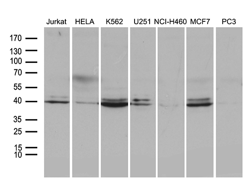 NFKBIE / IKB Epsilon Antibody - Western blot analysis of extracts. (35ug) from 7 different cell lines by using anti-NFKBIE monoclonal antibody. (1:500)