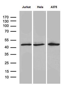 NFKBIE / IKB Epsilon Antibody - Western blot analysis of extracts. (35ug) from 3 different cell lines by using anti-NFKBIE monoclonal antibody. (1:500)