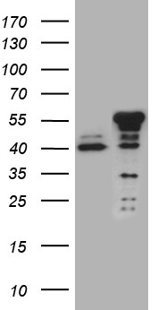 NFKBIE / IKB Epsilon Antibody - HEK293T cells were transfected with the pCMV6-ENTRY control. (Left lane) or pCMV6-ENTRY NFKBIE. (Right lane) cDNA for 48 hrs and lysed. Equivalent amounts of cell lysates. (5 ug per lane) were separated by SDS-PAGE and immunoblotted with anti-NFKBIE. (1:2000)