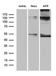 NFKBIE / IKB Epsilon Antibody - Western blot analysis of extracts. (35ug) from 3 different cell lines by using anti-NFKBIE monoclonal antibody. (1:500)