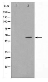 NFKBIE / IKB Epsilon Antibody - Western blot of IkappaB-epsilon expression in TNF-a treated HeLa whole cell lysates,The lane on the left is treated with the antigen-specific peptide.