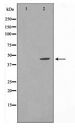 NFKBIE / IKB Epsilon Antibody - Western blot of IkappaB-epsilon expression in TNF-a treated HeLa whole cell lysates,The lane on the left is treated with the antigen-specific peptide.