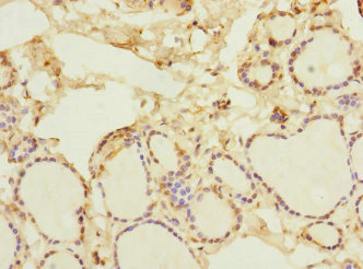 NFKBIE / IKB Epsilon Antibody - Immunohistochemistry of paraffin-embedded human thyroid tissue at dilution 1:100