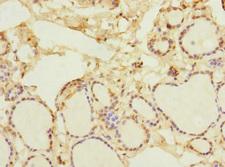 NFKBIE / IKB Epsilon Antibody - Immunohistochemistry of paraffin-embedded human thyroid tissue at dilution 1:100